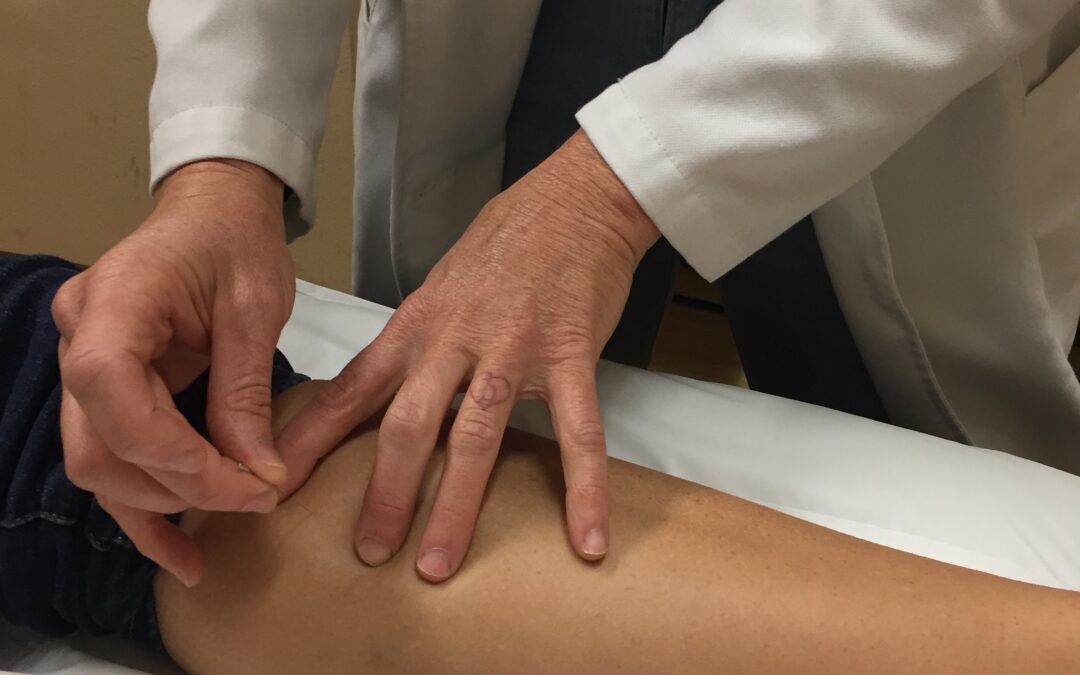 How Does Acupuncture Work?